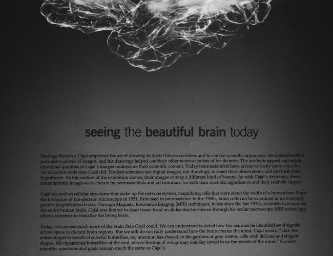 Framsteg inom Neuroteknik: Användningen av Hjärnvågsläsare och dess Potential